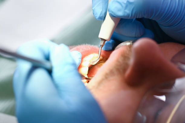 Best Emergency Dental Care for Abscessed Tooth in Trexlertown, PA